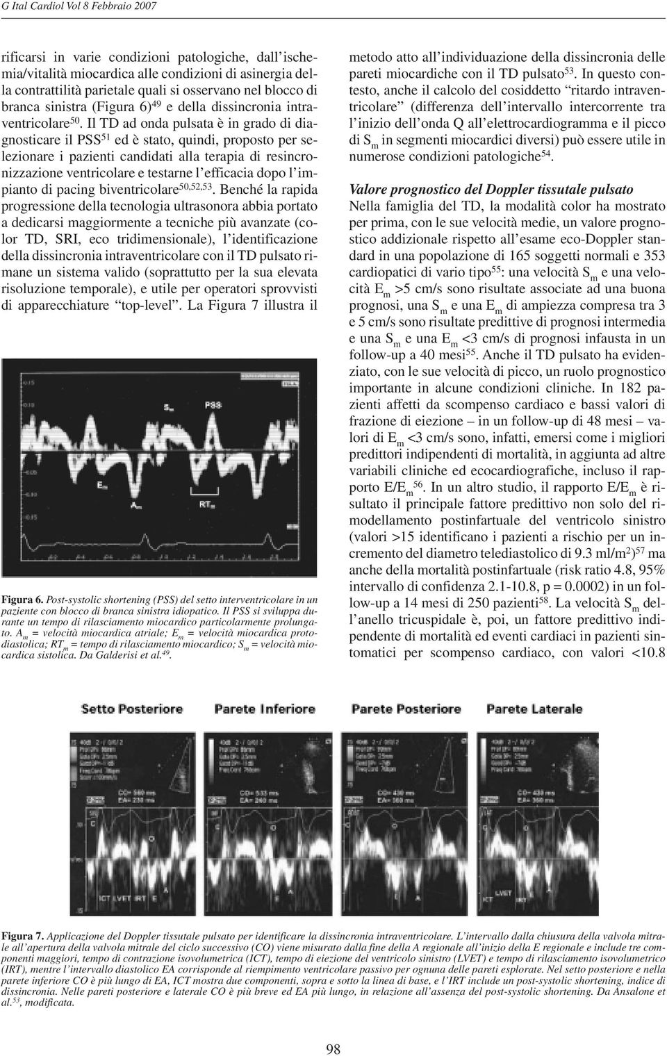 Il TD ad onda pulsata è in grado di diagnosticare il PSS 51 ed è stato, quindi, proposto per selezionare i pazienti candidati alla terapia di resincronizzazione ventricolare e testarne l efficacia