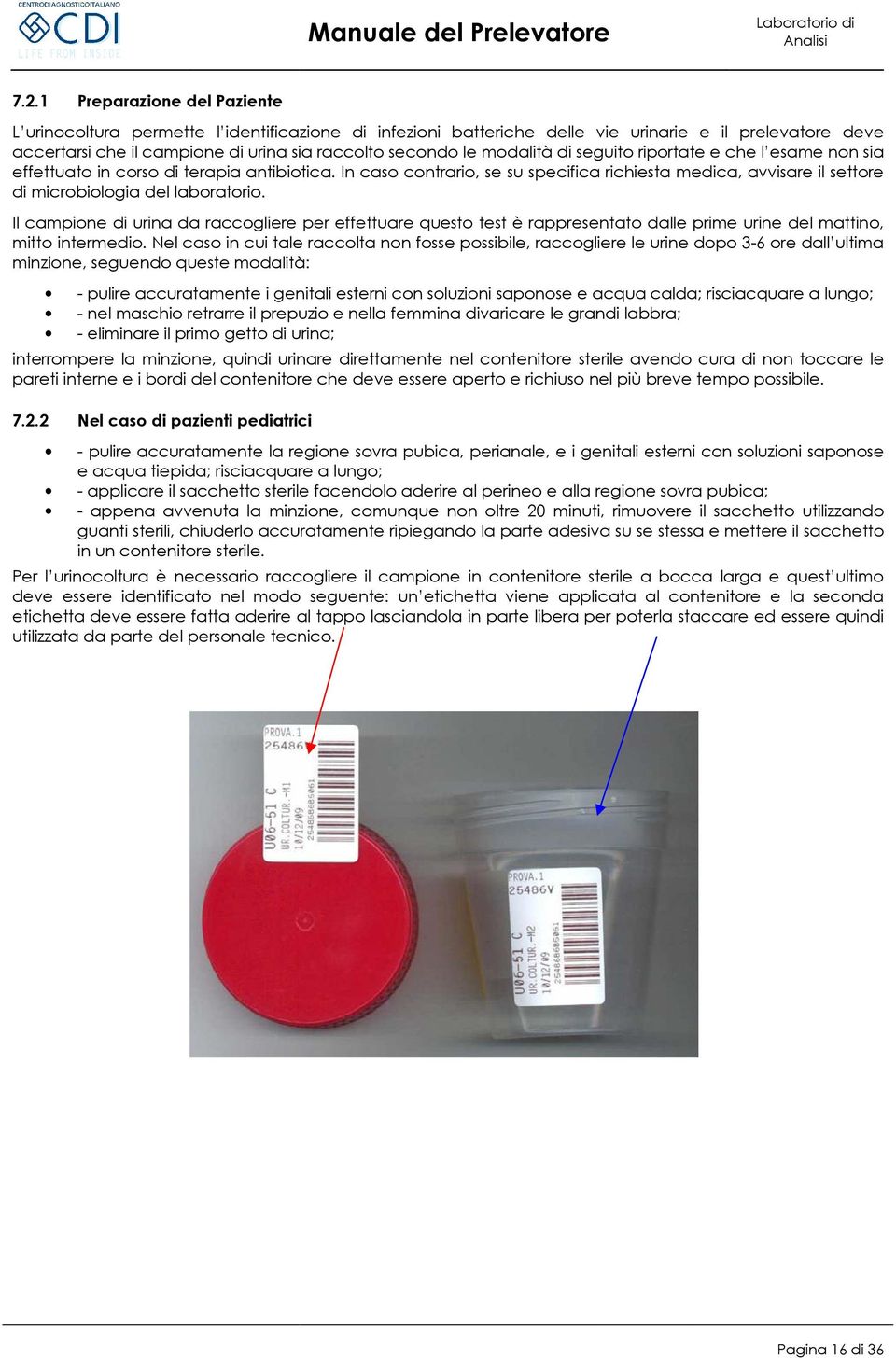 In caso contrario, se su specifica richiesta medica, avvisare il settore di microbiologia del laboratorio.