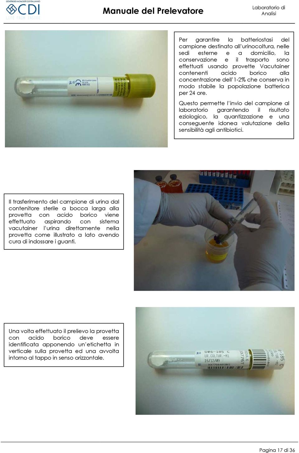 Questo permette l invio del campione al laboratorio garantendo il risultato eziologico, la quantizzazione e una conseguente idonea valutazione della sensibilità agli antibiotici.