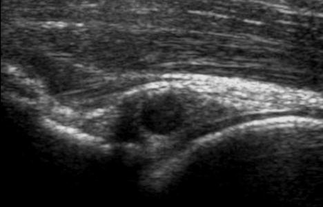 muscolo-tendinee: - traumatiche - da sovraccarico funzionale IPs