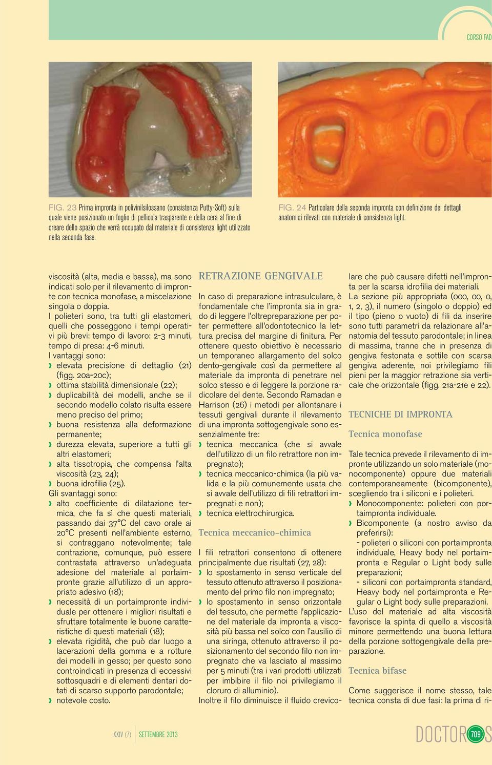 materiale di consistenza light utilizzato nella seconda fase. FIG. 24 Particolare della seconda impronta con definizione dei dettagli anatomici rilevati con materiale di consistenza light.