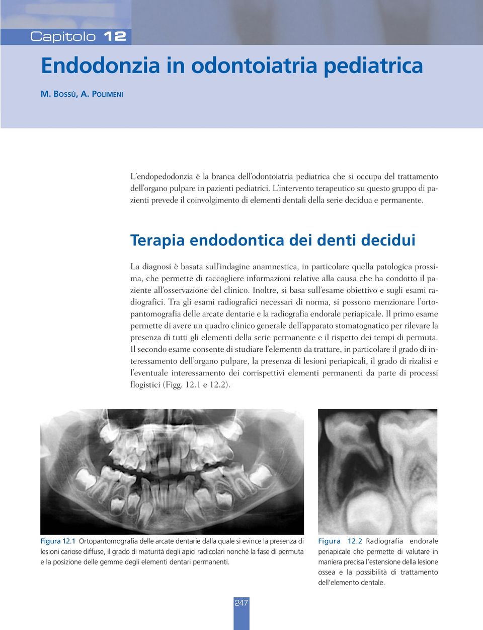 Terapia endodontica dei denti decidui La diagnosi è basata sull indagine anamnestica, in particolare quella patologica prossima, che permette di raccogliere informazioni relative alla causa che ha