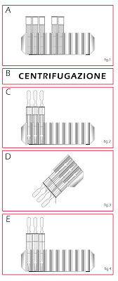 Ex. 3 (number of cells counted) X 10 = 3 cells/µl 10 FAST-READ 102 consente di contare gli elementi cellulari in modo semplice e veloce.