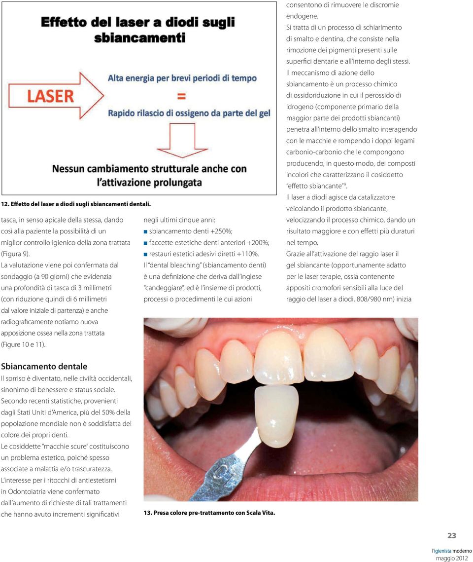 radiograficamente notiamo nuova apposizione ossea nella zona trattata (Figure 10 e 11).