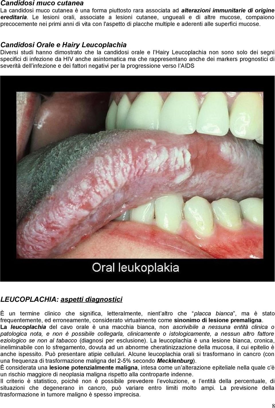 Candidosi Orale e Hairy Leucoplachia Diversi studi hanno dimostrato che la candidosi orale e l Hairy Leucoplachia non sono solo dei segni specifici di infezione da HIV anche asintomatica ma che