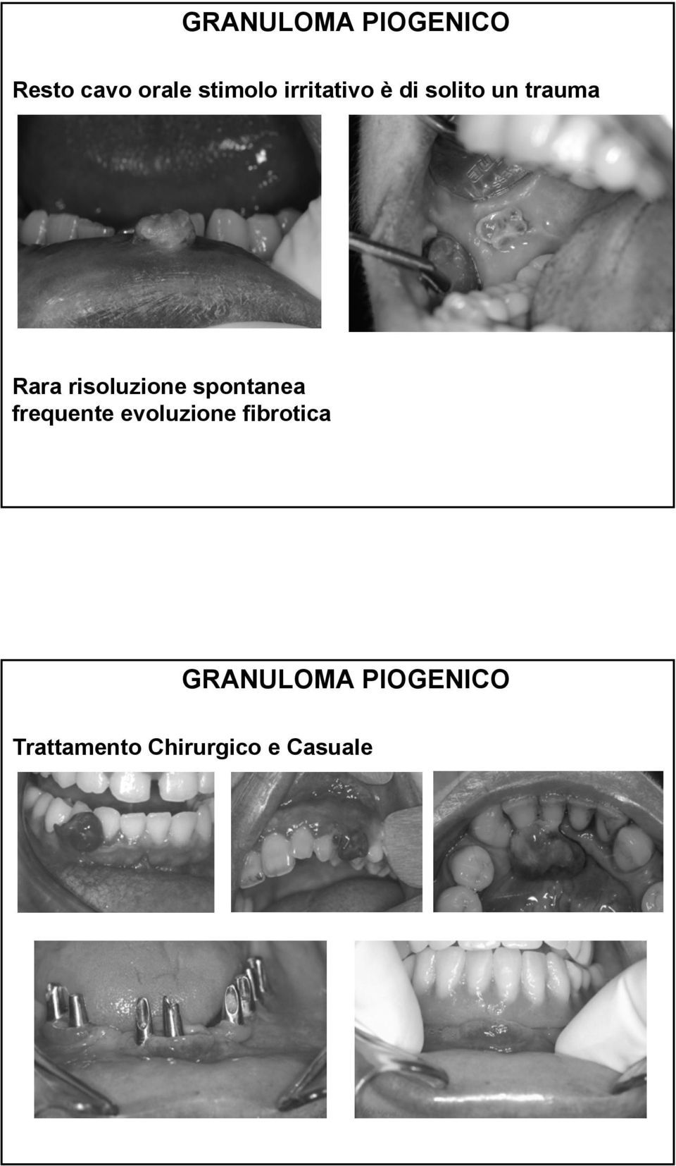 risoluzione spontanea frequente evoluzione