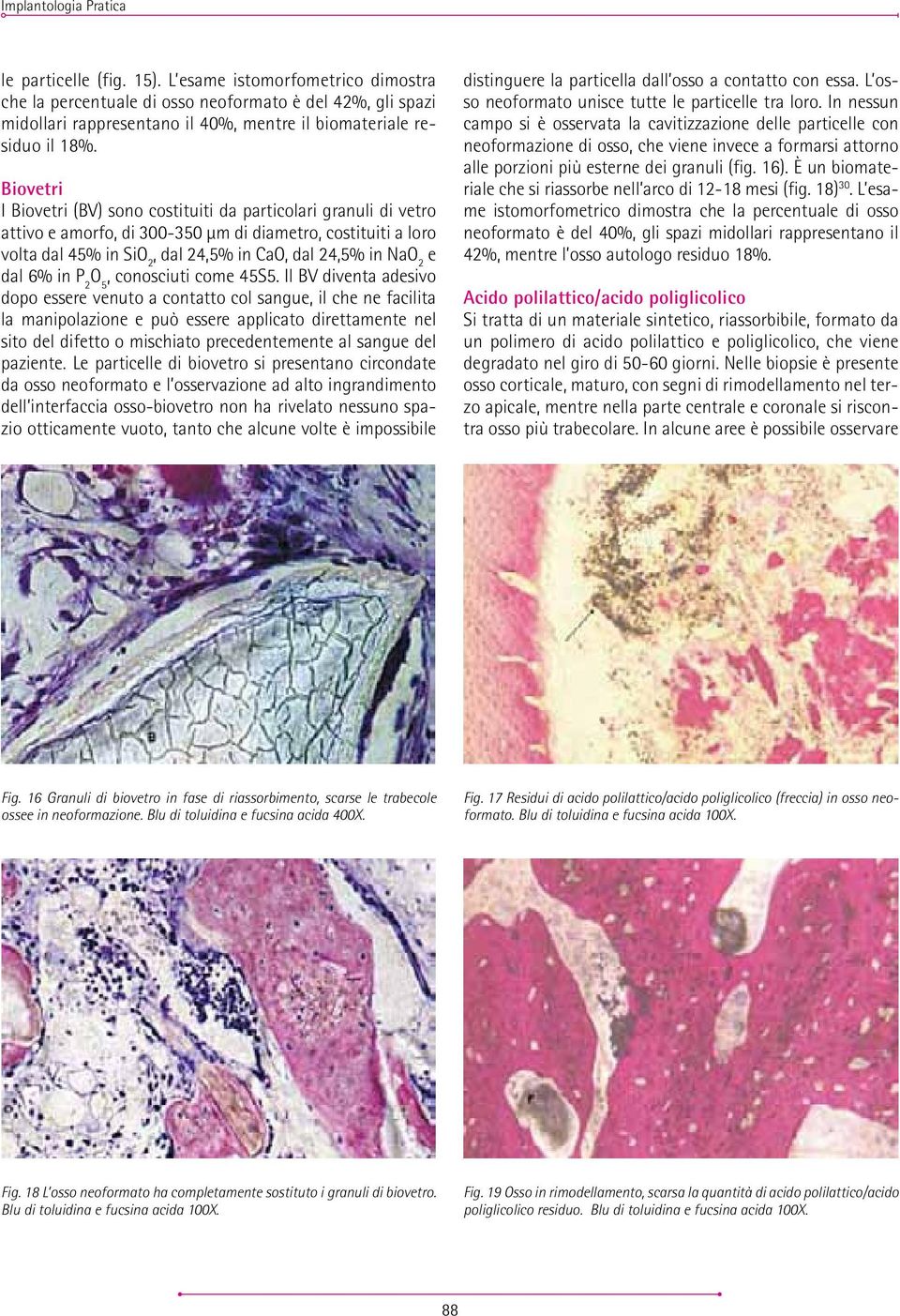 Biovetri I Biovetri (BV) sono costituiti da particolari granuli di vetro attivo e amorfo, di 300-350 µm di diametro, costituiti a loro volta dal 45% in SiO 2, dal 24,5% in CaO, dal 24,5% in NaO 2 e