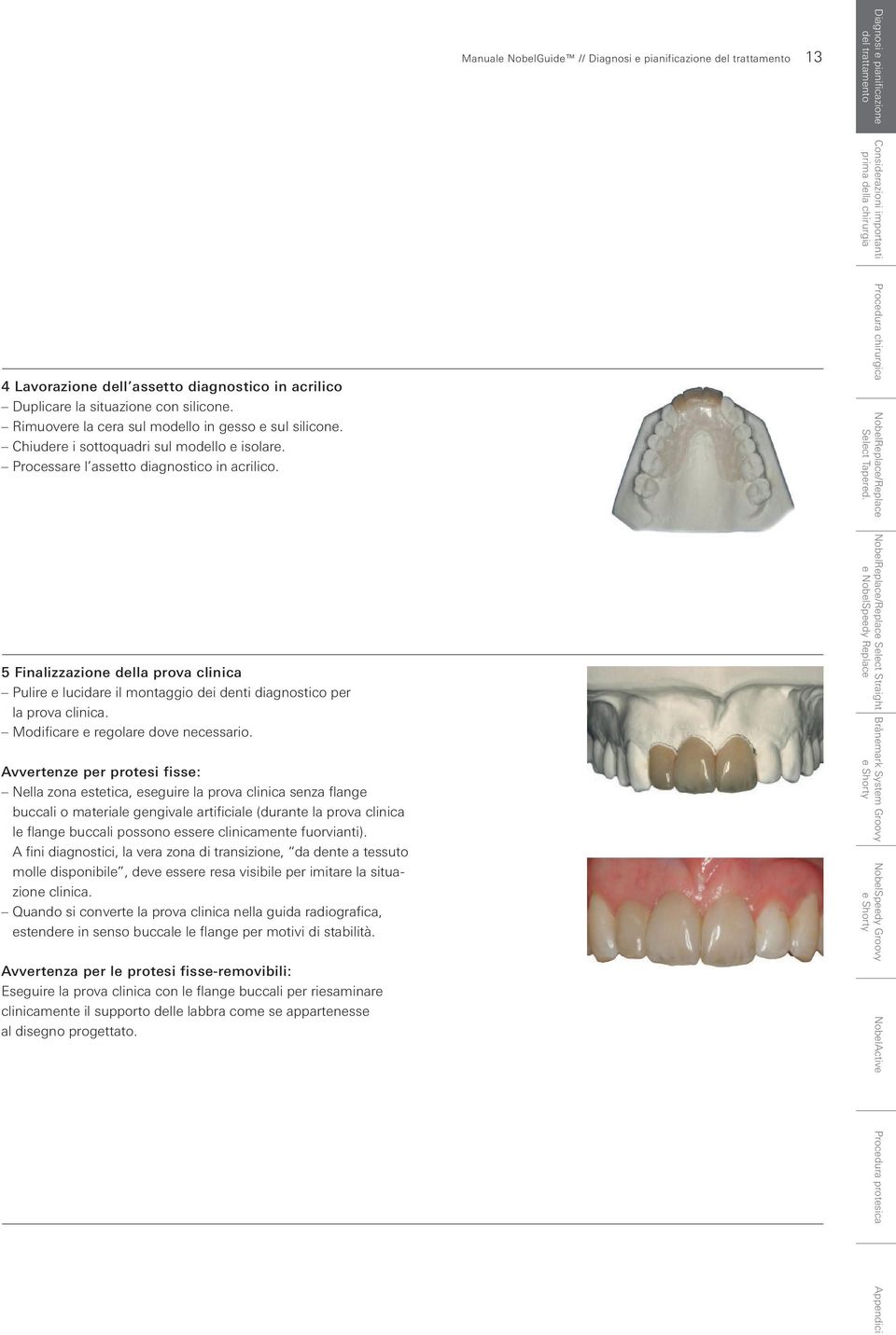 Procedura chirurgica NobelReplace/Replace Select Tapered. 5 Finalizzazione della prova clinica Pulire e lucidare il montaggio dei denti diagnostico per la prova clinica.