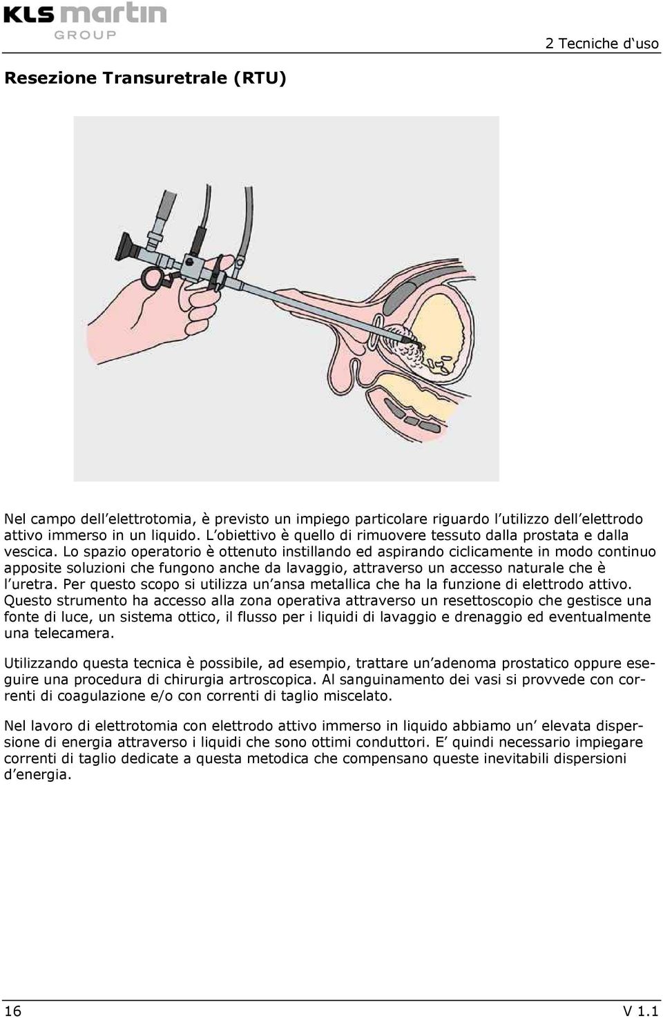 Lo spazio operatorio è ottenuto instillando ed aspirando ciclicamente in modo continuo apposite soluzioni che fungono anche da lavaggio, attraverso un accesso naturale che è l uretra.