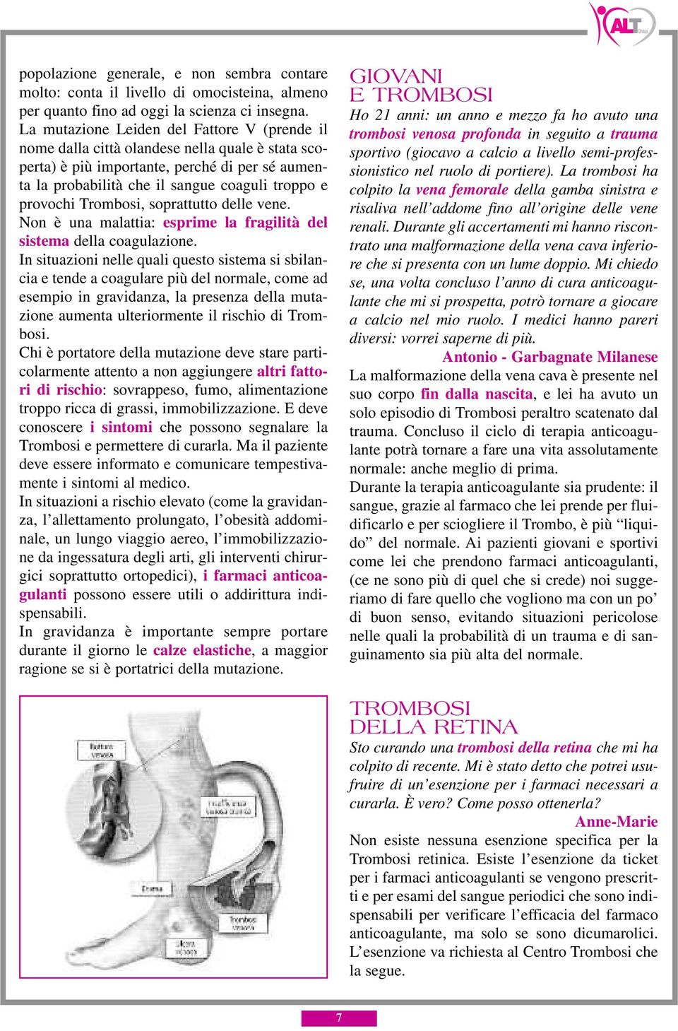 Trombosi, soprattutto delle vene. Non è una malattia: esprime la fragilità del sistema della coagulazione.