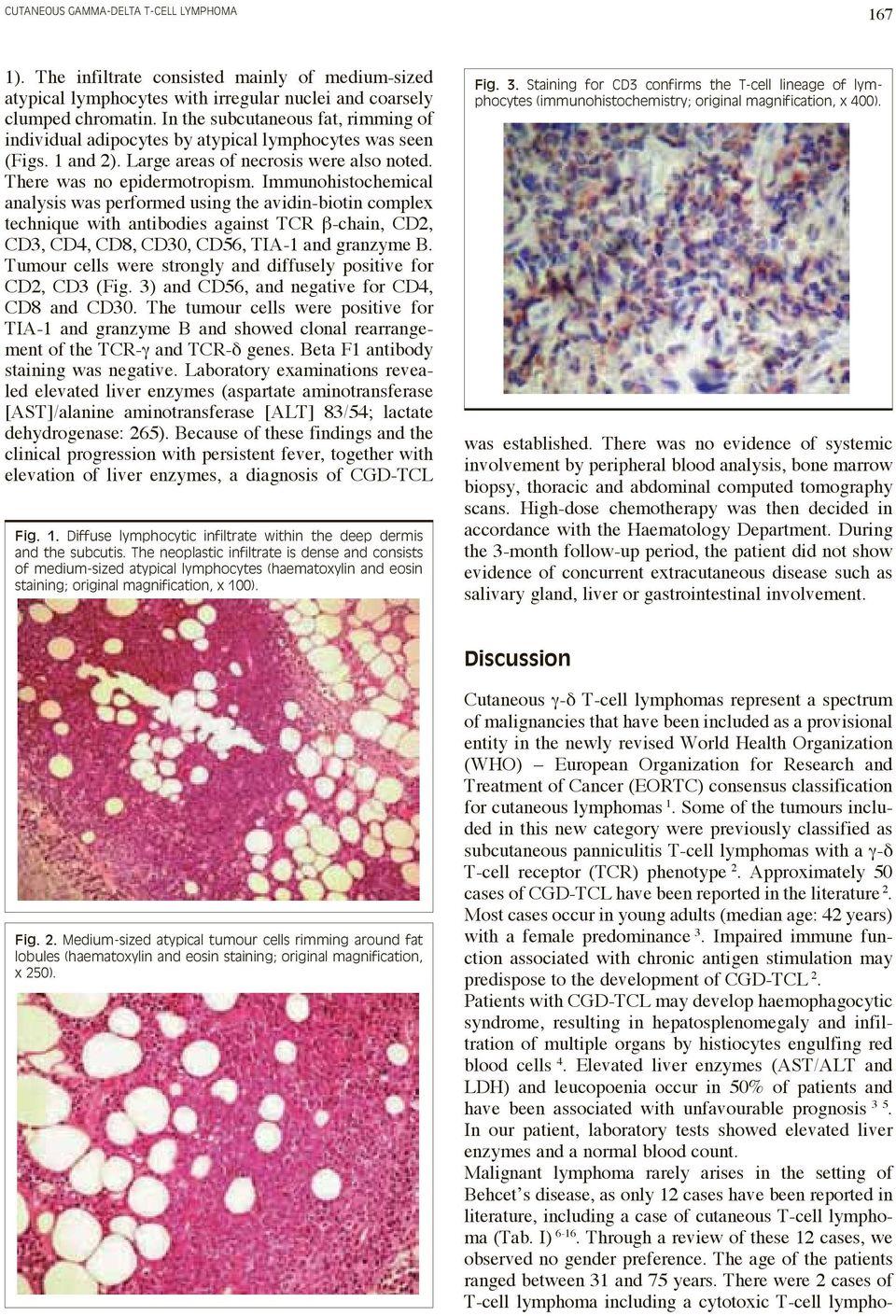 Immunohistochemical analysis was performed using the avidin-biotin complex technique with antibodies against TCR β-chain, CD2, CD3, CD4, CD8, CD30, CD56, TIA-1 and granzyme B.