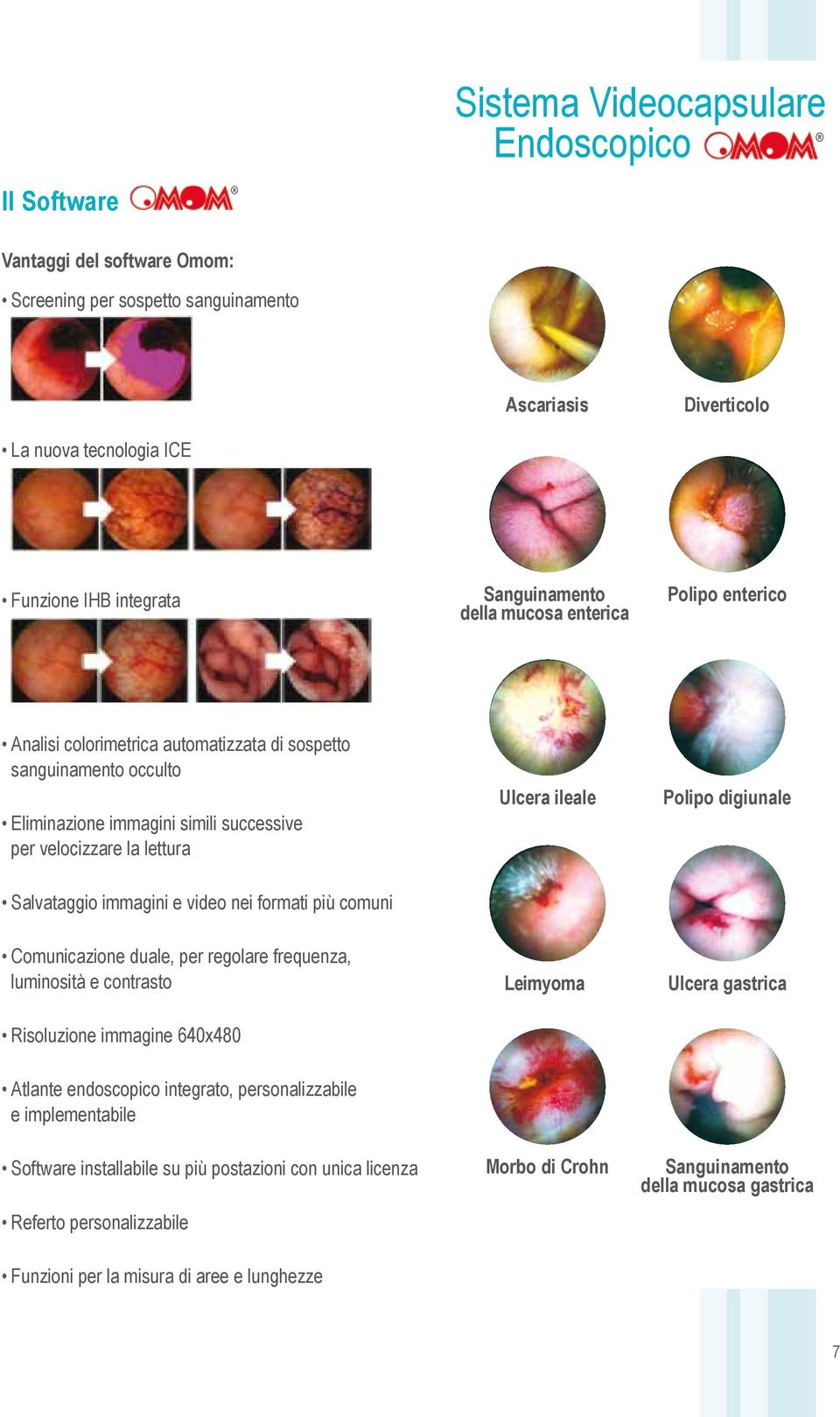 digiunale Salvataggio immagini e video nei formati più comuni Comunicazione duale, per regolare frequenza, luminosità e contrasto Risoluzione immagine 640x480 Leimyoma Ulcera gastrica Atlante