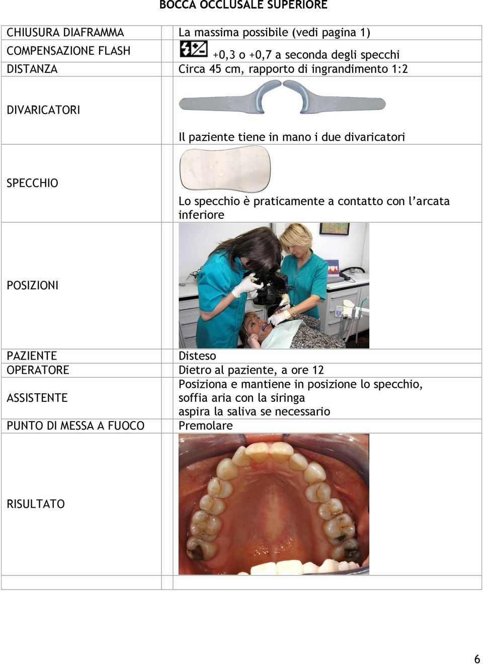 specchio è praticamente a contatto con l arcata inferiore POSIZIONI PAZIENTE Disteso OPERATORE Dietro al paziente, a ore 12 Posiziona e