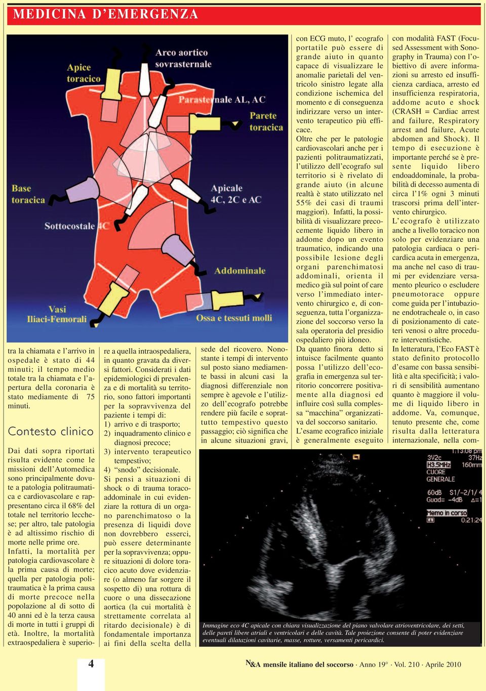 totale nel territorio lecchese; per altro, tale patologia è ad altissimo rischio di morte nelle prime ore.