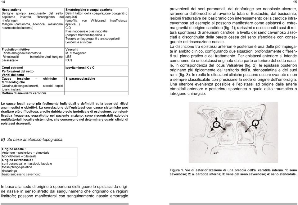 , melanoma, epatica ) papilloma invertito, fibroangioma del acquisiti neuroestesioblastoma) CID rinofaringe) (emofilia, von Willebrand, insufficienza Piastrinopenie e piastrinopatie Maligne