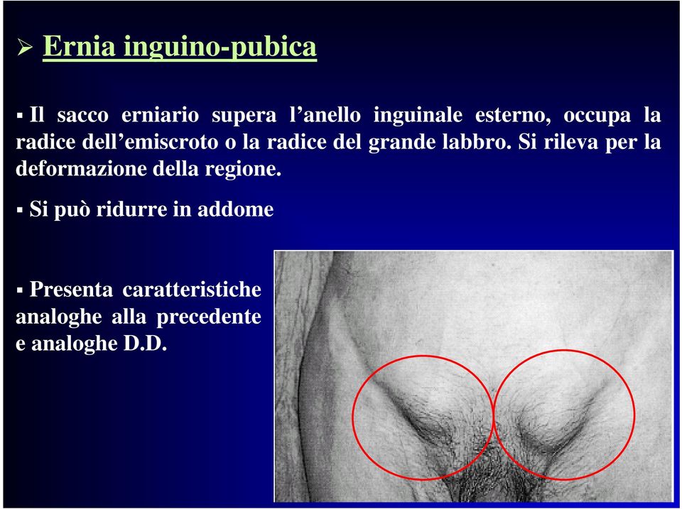 labbro. Si rileva per la deformazione della regione.