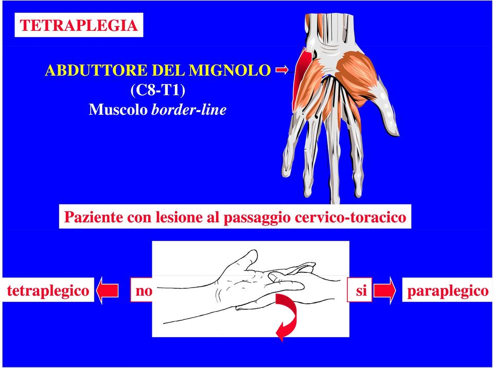 Paziente con lesione al passaggio