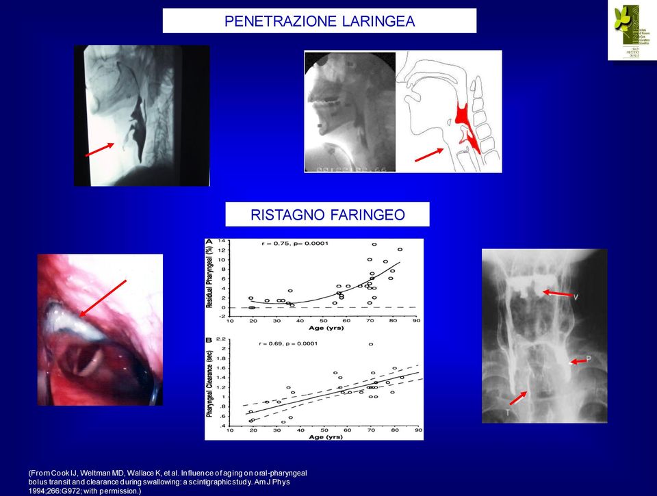 Influence of aging on oral-pharyngeal bolus transit and