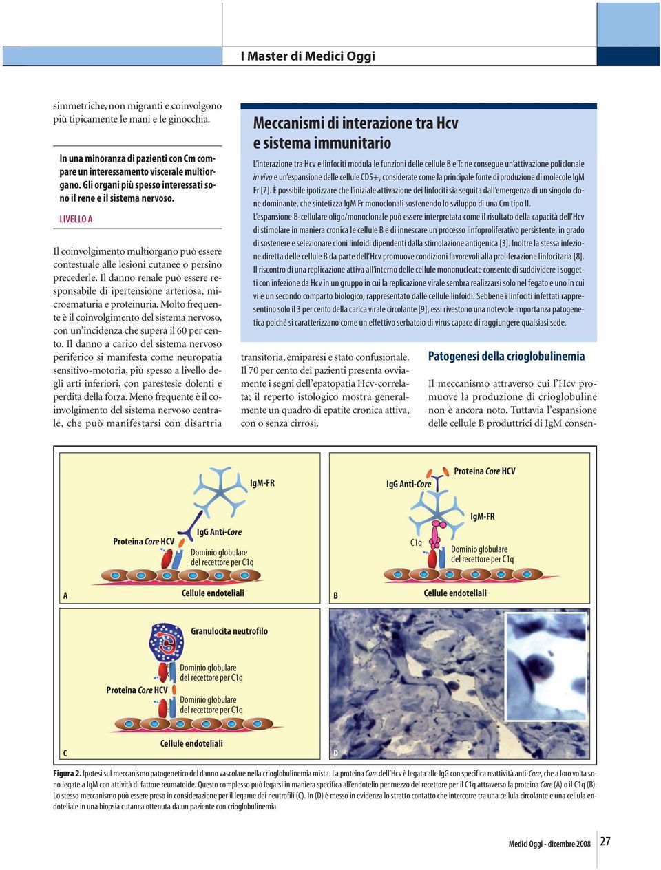 Il danno renale può essere responsabile di ipertensione arteriosa, microematuria e proteinuria. Molto frequente è il coinvolgimento del sistema nervoso, con un incidenza che supera il 60 per cento.