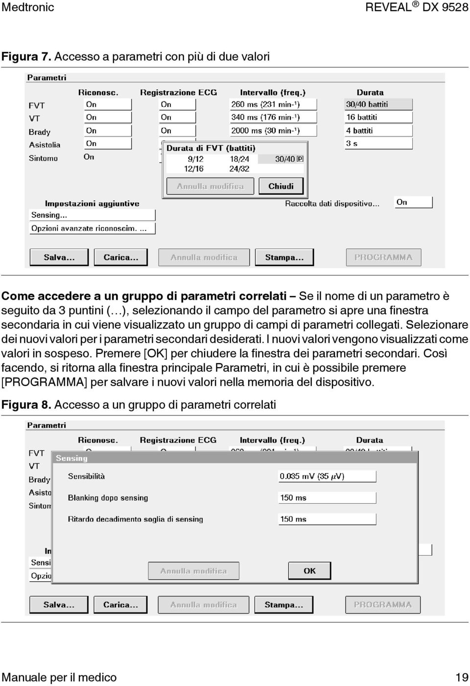 parametro si apre una finestra secondaria in cui viene visualizzato un gruppo di campi di parametri collegati. Selezionare dei nuovi valori per i parametri secondari desiderati.