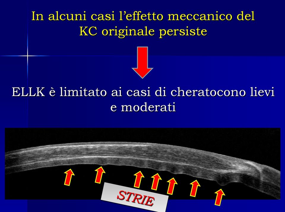 persiste ELLK è limitato ai