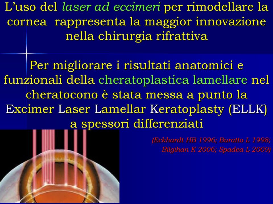 cheratoplastica lamellare nel cheratocono è stata messa a punto la Excimer Laser Lamellar