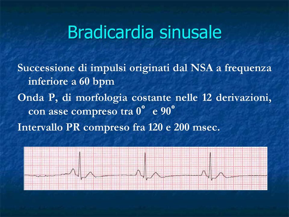 morfologia costante nelle 12 derivazioni, con asse