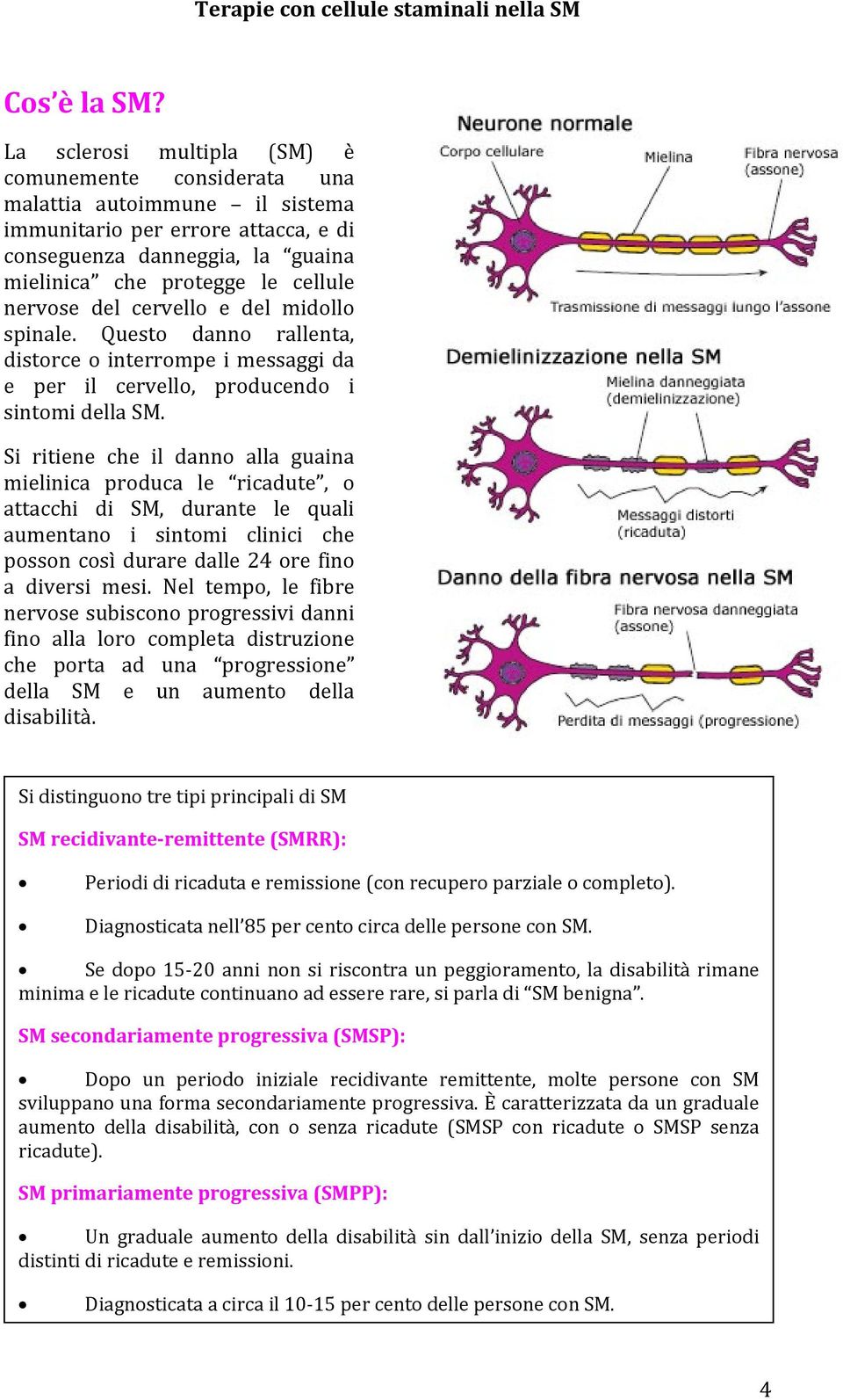 del cervello e del midollo spinale. Questo danno rallenta, distorce o interrompe i messaggi da e per il cervello, producendo i sintomi della SM.