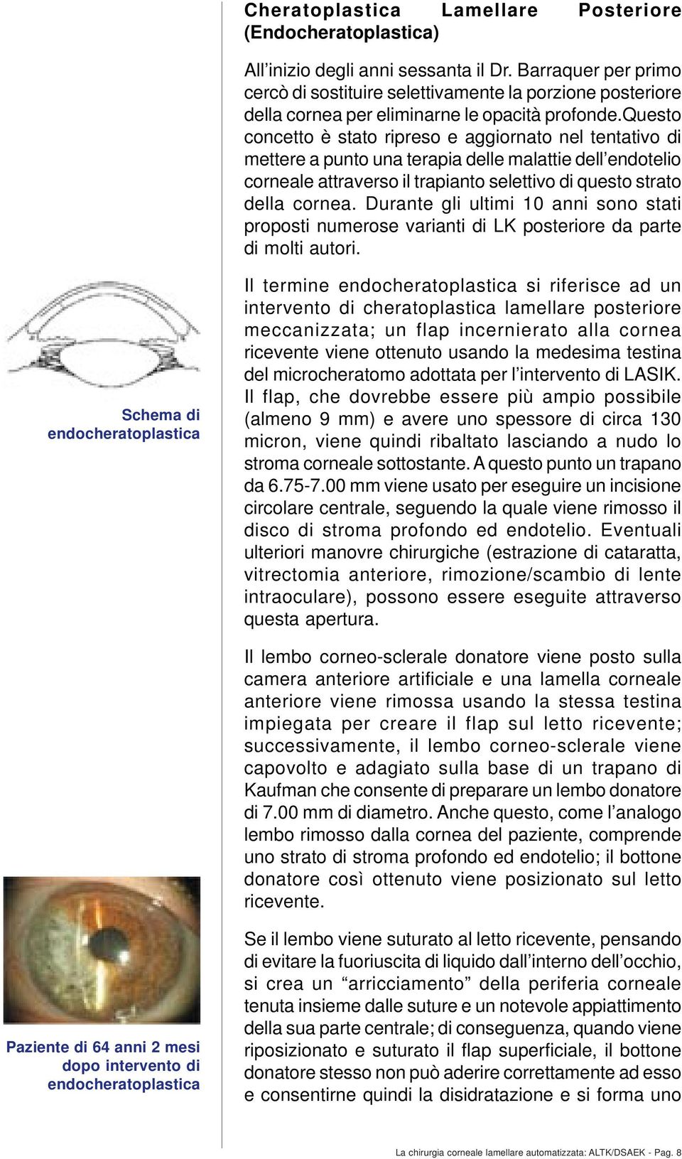 questo concetto è stato ripreso e aggiornato nel tentativo di mettere a punto una terapia delle malattie dell endotelio corneale attraverso il trapianto selettivo di questo strato della cornea.