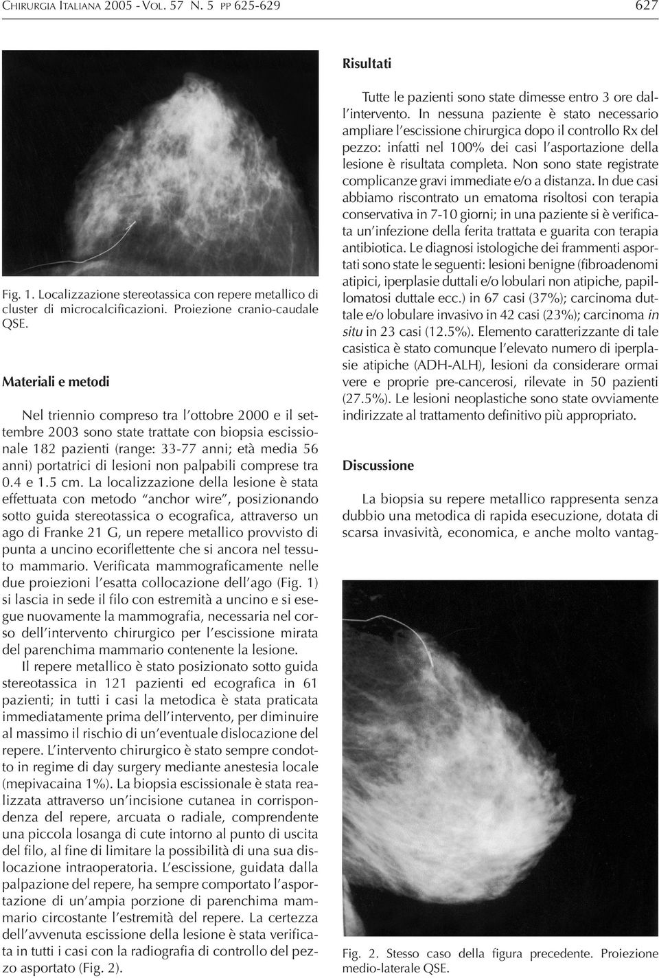 Tale tecnica può essere utilizzata in tutti i casi di lesioni non palpabili, ma soprattutto è indicata nelle mammelle in cui la componente ghiandolare prevale sul tessuto adiposo, poiché consente un