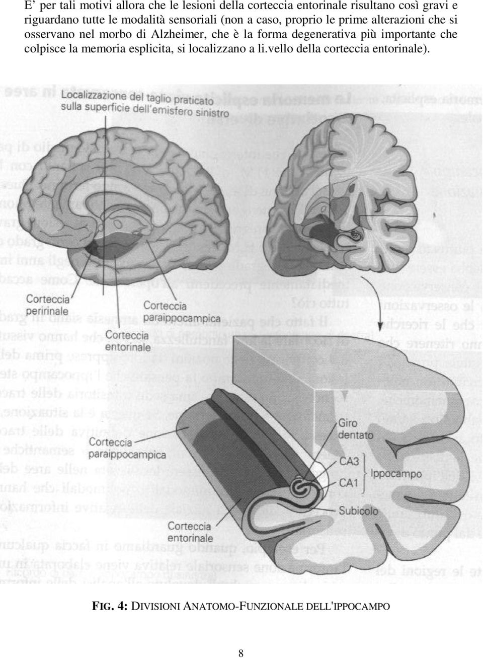 nel morbo di Alzheimer, che è la forma degenerativa più importante che colpisce la memoria