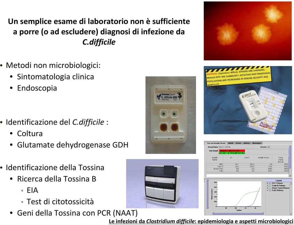 difficile Metodi non microbiologici: Sintomatologia clinica Endoscopia Identificazione