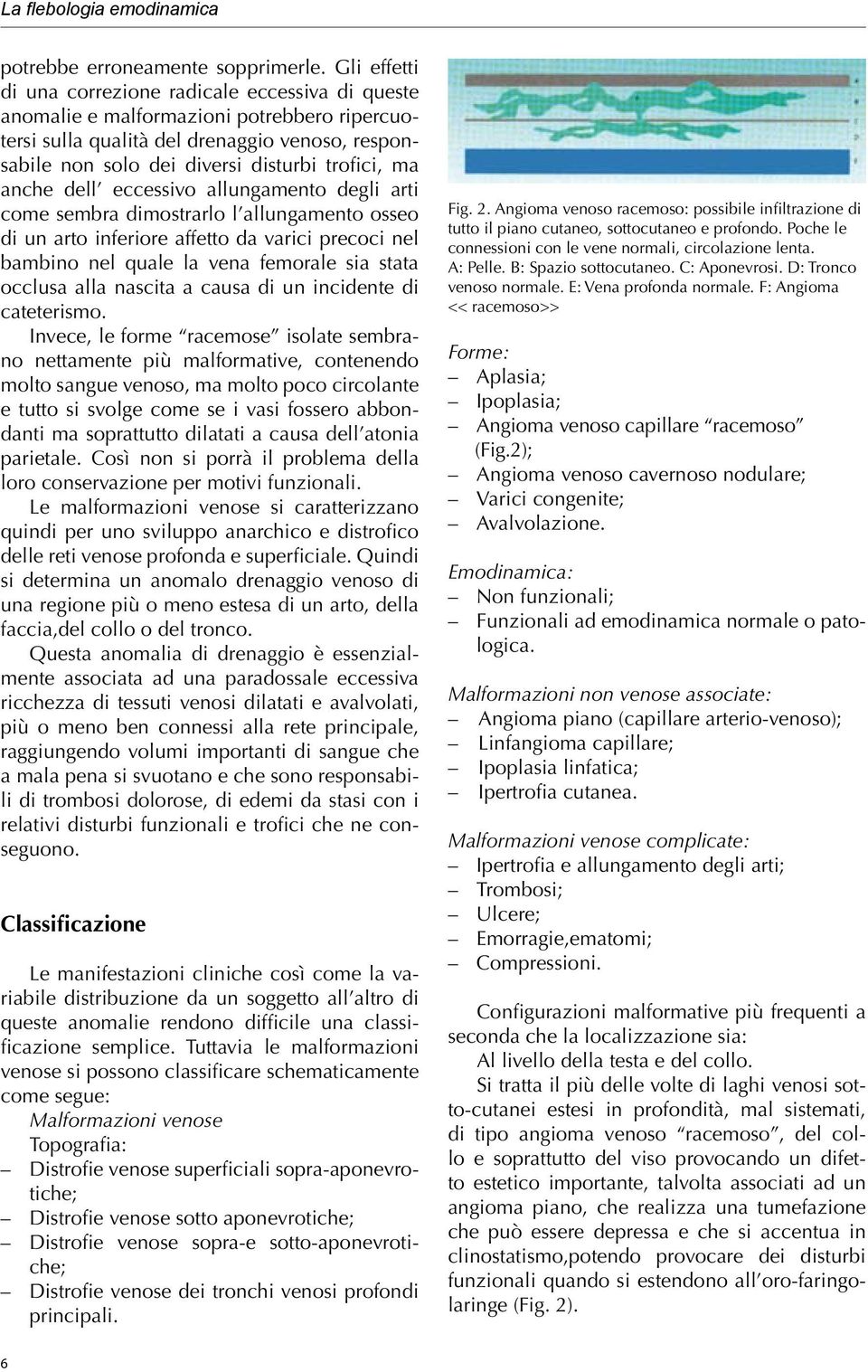 anche dell eccessivo allungamento degli arti come sembra dimostrarlo l allungamento osseo di un arto inferiore affetto da varici precoci nel bambino nel quale la vena femorale sia stata occlusa alla