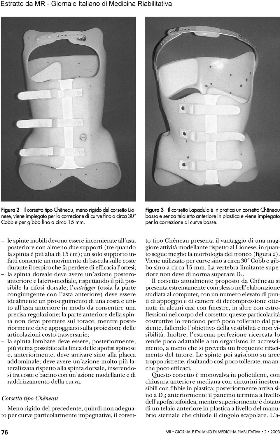 le spinte mobili devono essere incernierate all asta posteriore con almeno due supporti (tre quando la spinta è più alta di 15 cm); un solo supporto infatti consente un movimento di bascula sulle