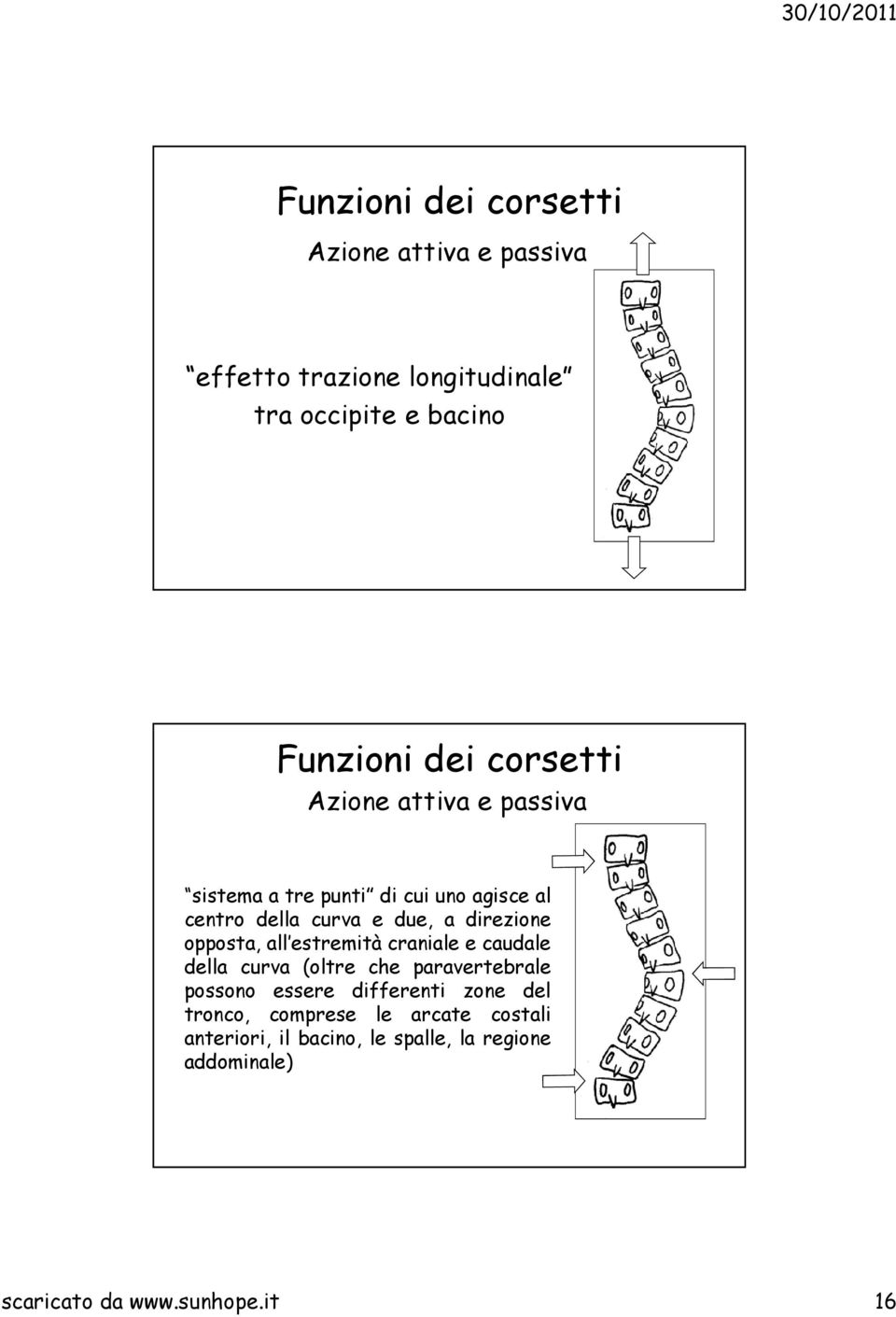 opposta, all estremità craniale e caudale della curva (oltre che paravertebrale possono essere differenti zone del