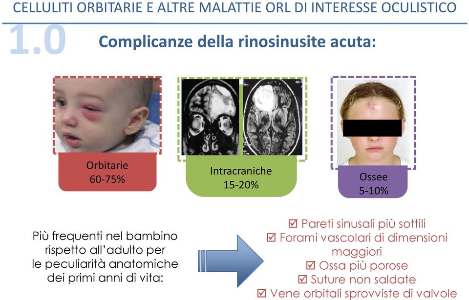 anatomiche dei primi anni di vita: Pareti sinusali più sottili Forami vascolari di