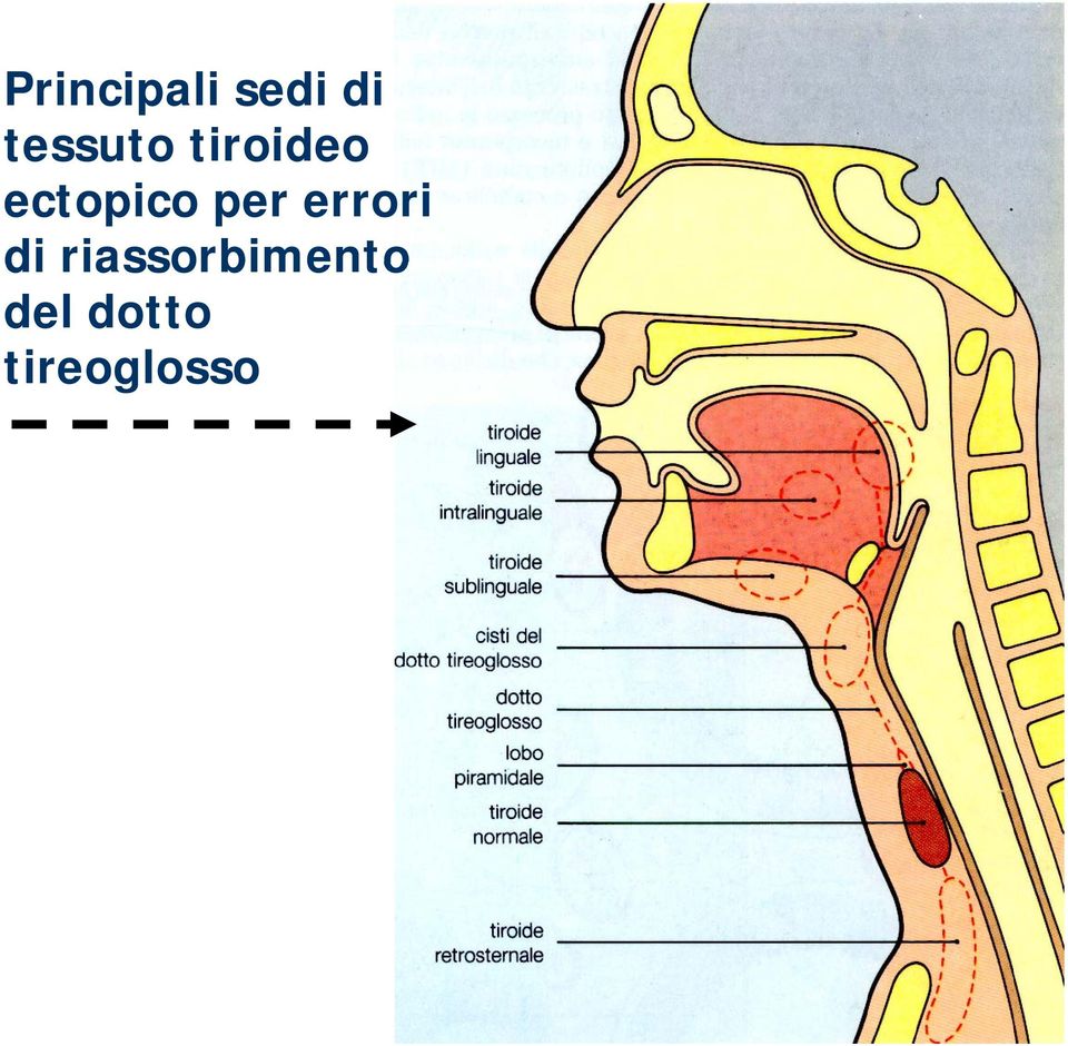 ectopico per errori di