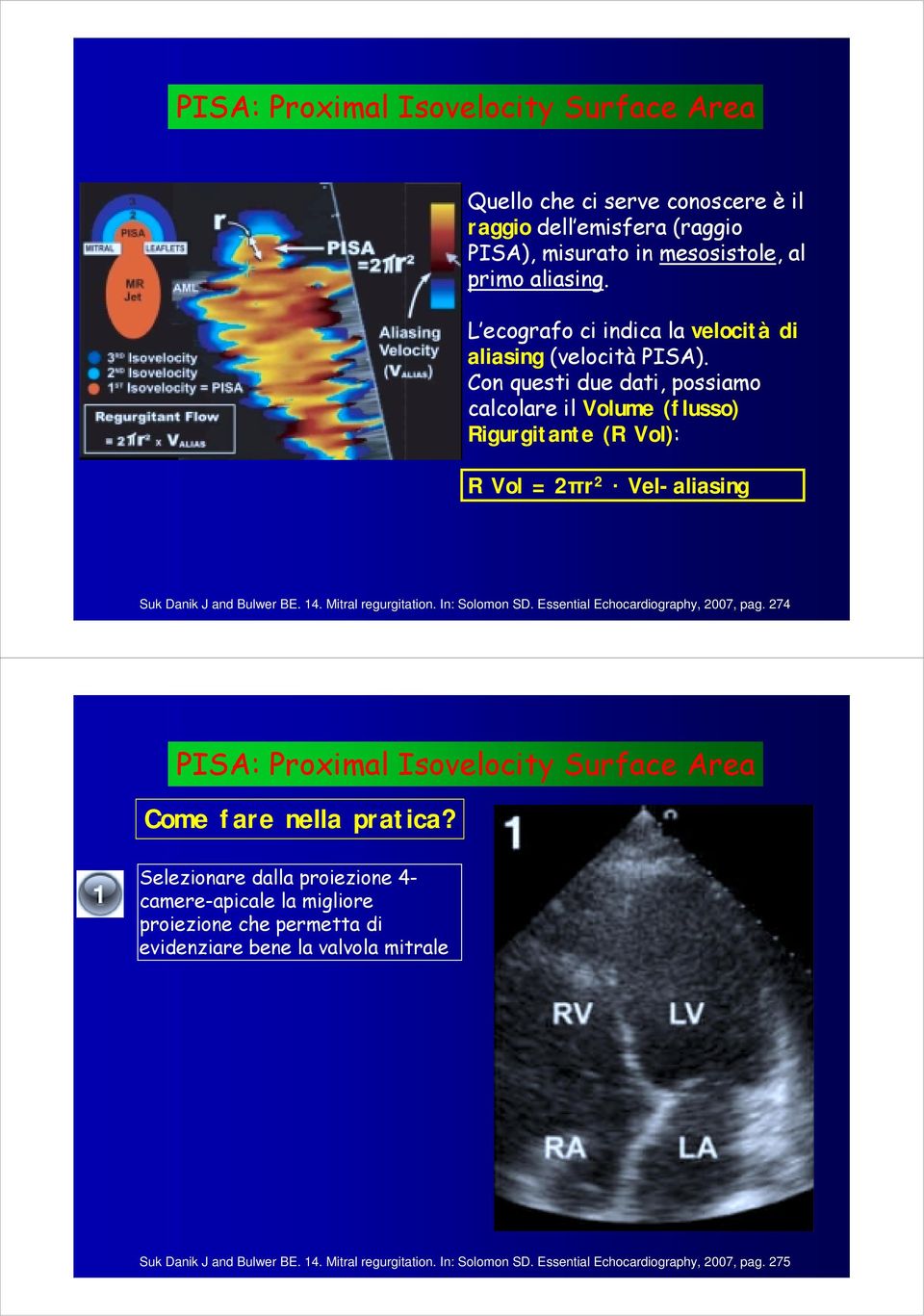 Con questi due dati, possiamo calcolare il Volume (flusso) Rigurgitante (R Vol): R Vol = 2πr 2 Vel-aliasing Suk Danik J and Bulwer BE. 14. Mitral regurgitation. In: Solomon SD.