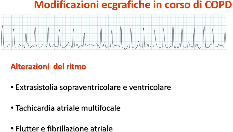 sopraventricolare e ventricolare