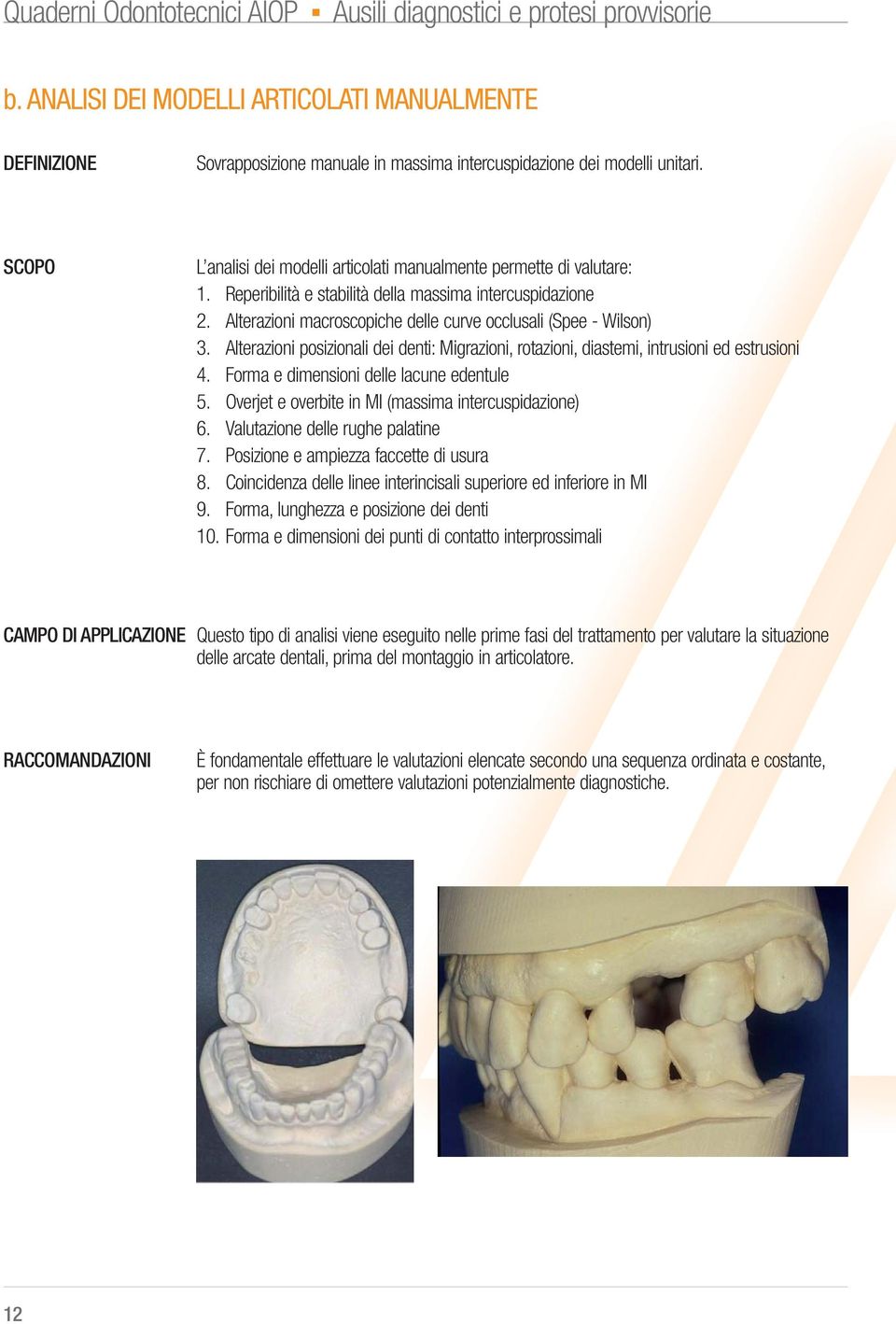 Alterazioni macroscopiche delle curve occlusali (Spee - Wilson) 3. Alterazioni posizionali dei denti: Migrazioni, rotazioni, diastemi, intrusioni ed estrusioni 4.