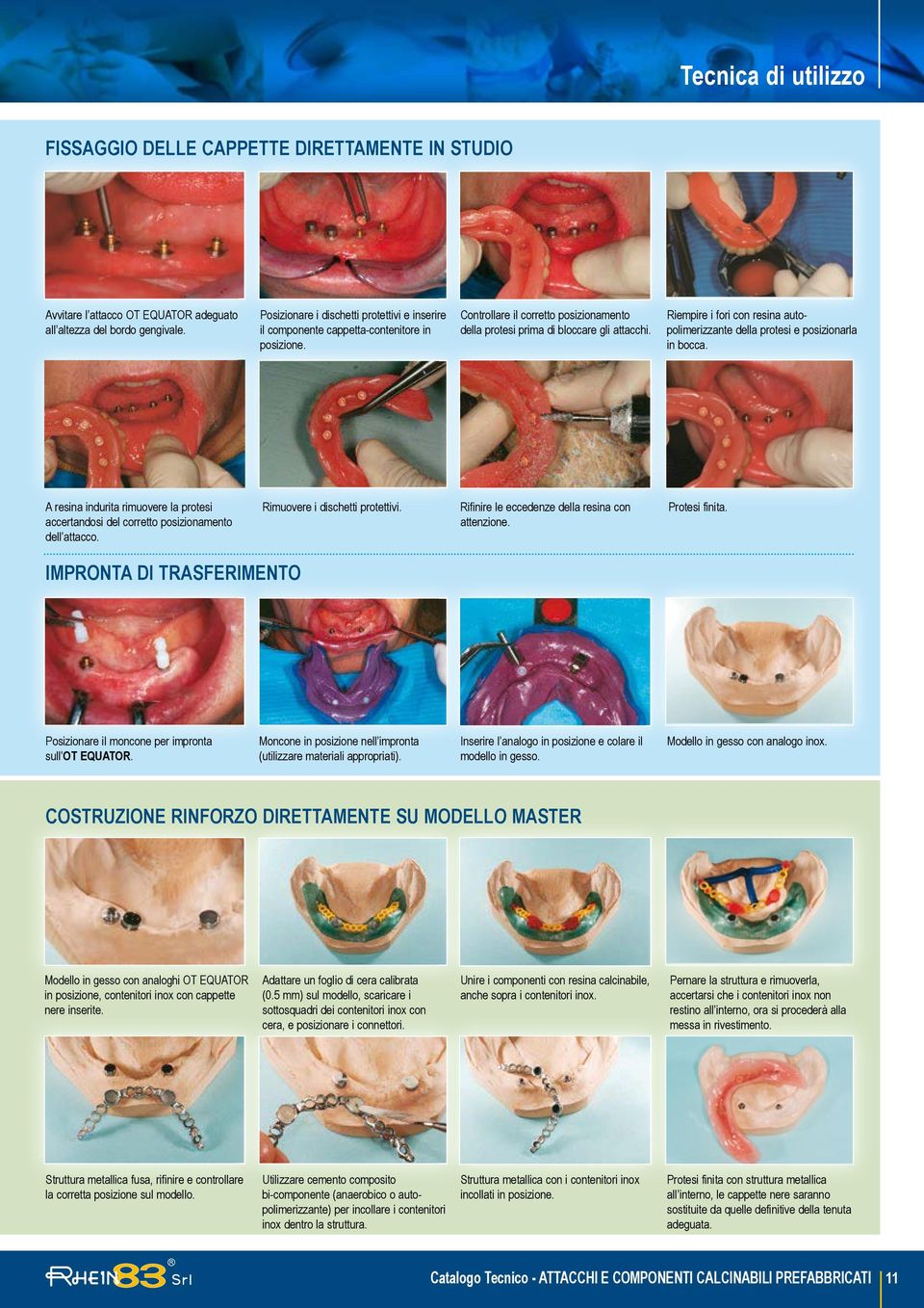 Riempire i fori con resina autopolimerizzante della protesi e posizionarla in bocca. A resina indurita rimuovere la protesi accertandosi del corretto posizionamento dell attacco.