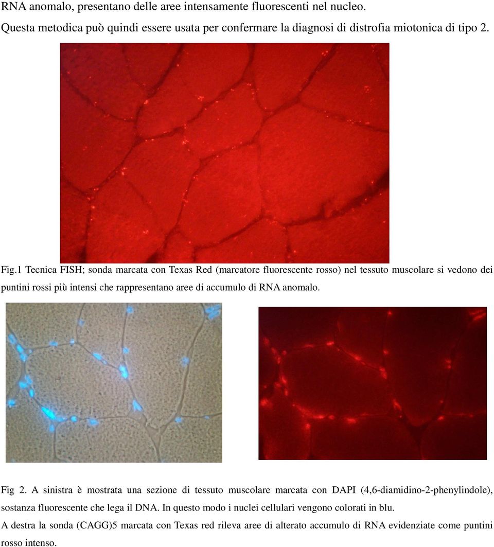 di RNA anomalo. Fig 2. A sinistra è mostrata una sezione di tessuto muscolare marcata con DAPI (4,6-diamidino-2-phenylindole), sostanza fluorescente che lega il DNA.