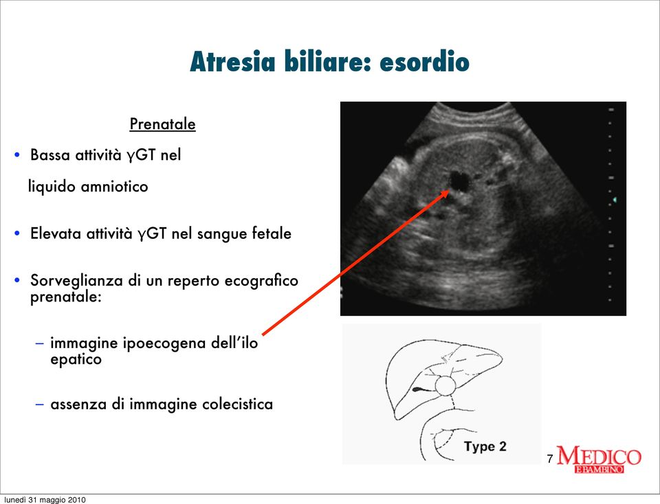 Sorveglianza di un reperto ecografico prenatale: immagine