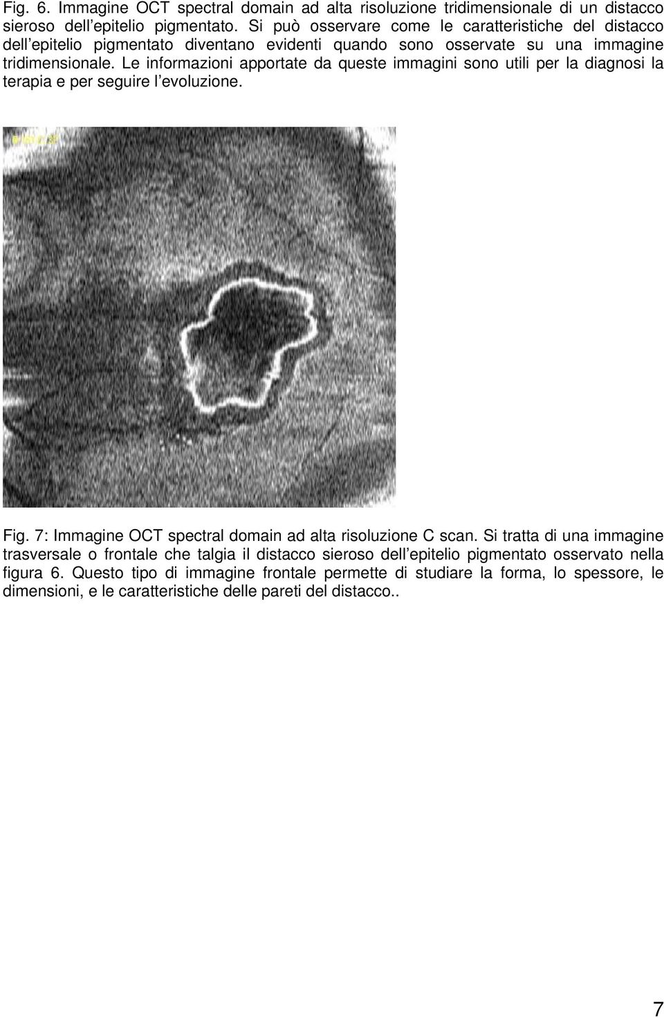 Le informazioni apportate da queste immagini sono utili per la diagnosi la terapia e per seguire l evoluzione. Fig. 7: Immagine OCT spectral domain ad alta risoluzione C scan.