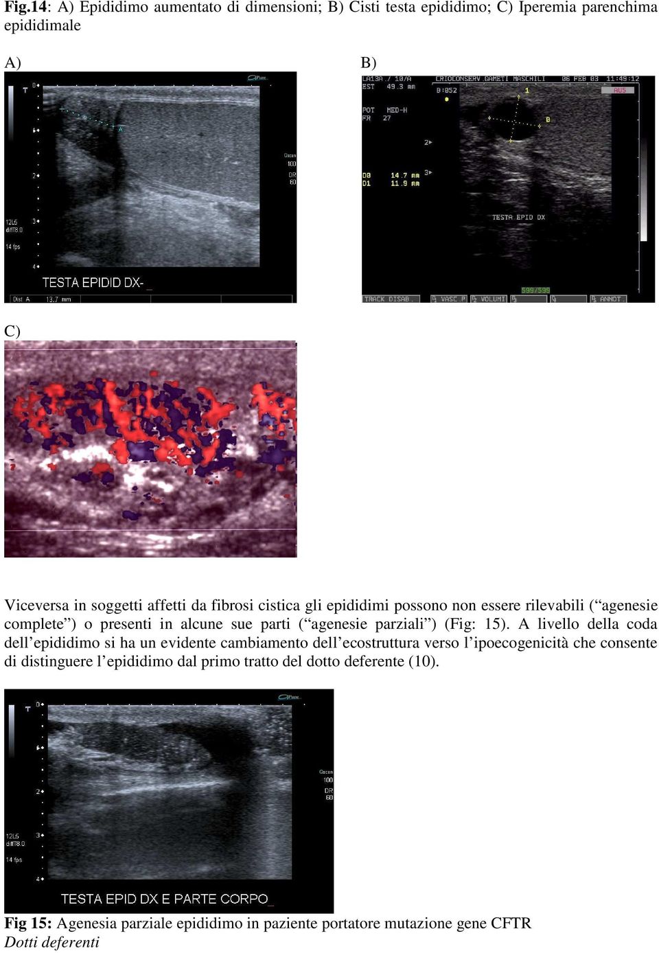 ) (Fig: 15).