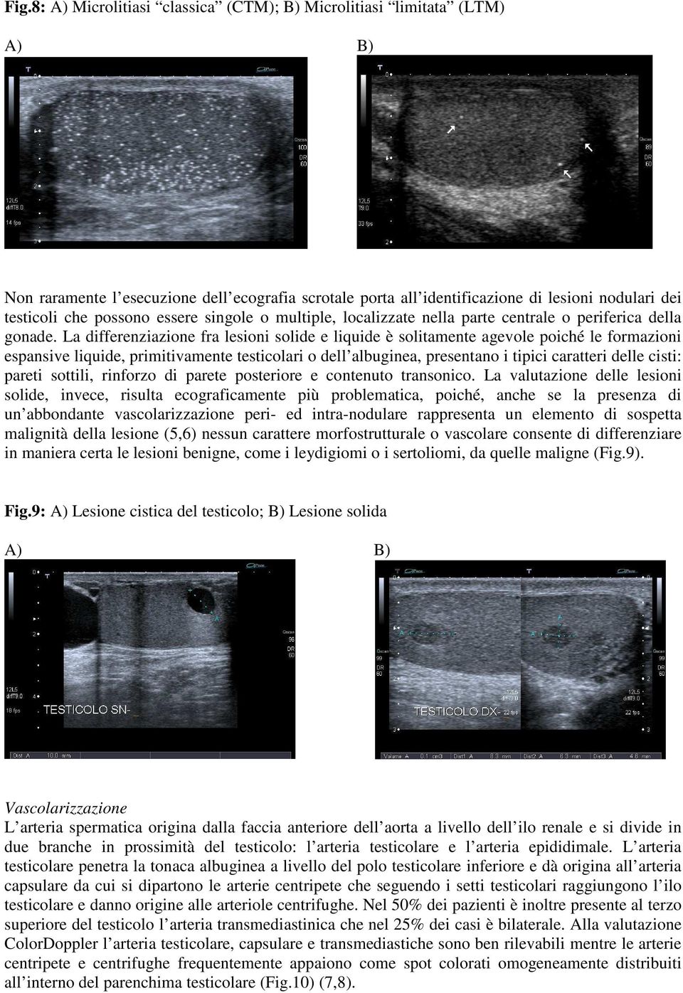 La differenziazione fra lesioni solide e liquide è solitamente agevole poiché le formazioni espansive liquide, primitivamente testicolari o dell albuginea, presentano i tipici caratteri delle cisti: