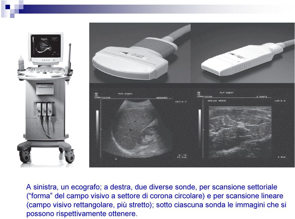 per scansione lineare (campo visivo rettangolare, più stretto);