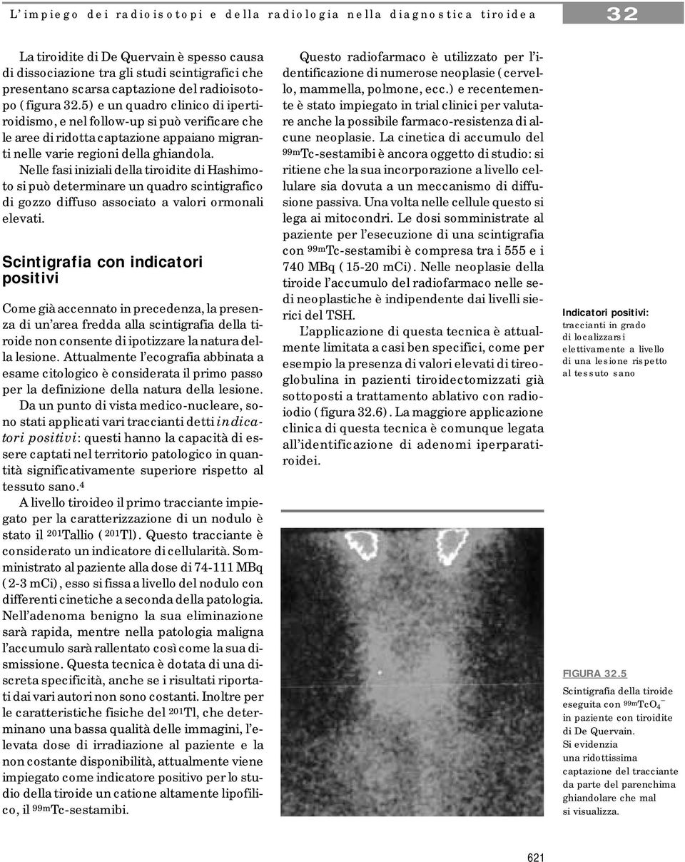 Nelle fasi iniziali della tiroidite di Hashimoto si può determinare un quadro scintigrafico di gozzo diffuso associato a valori ormonali elevati.