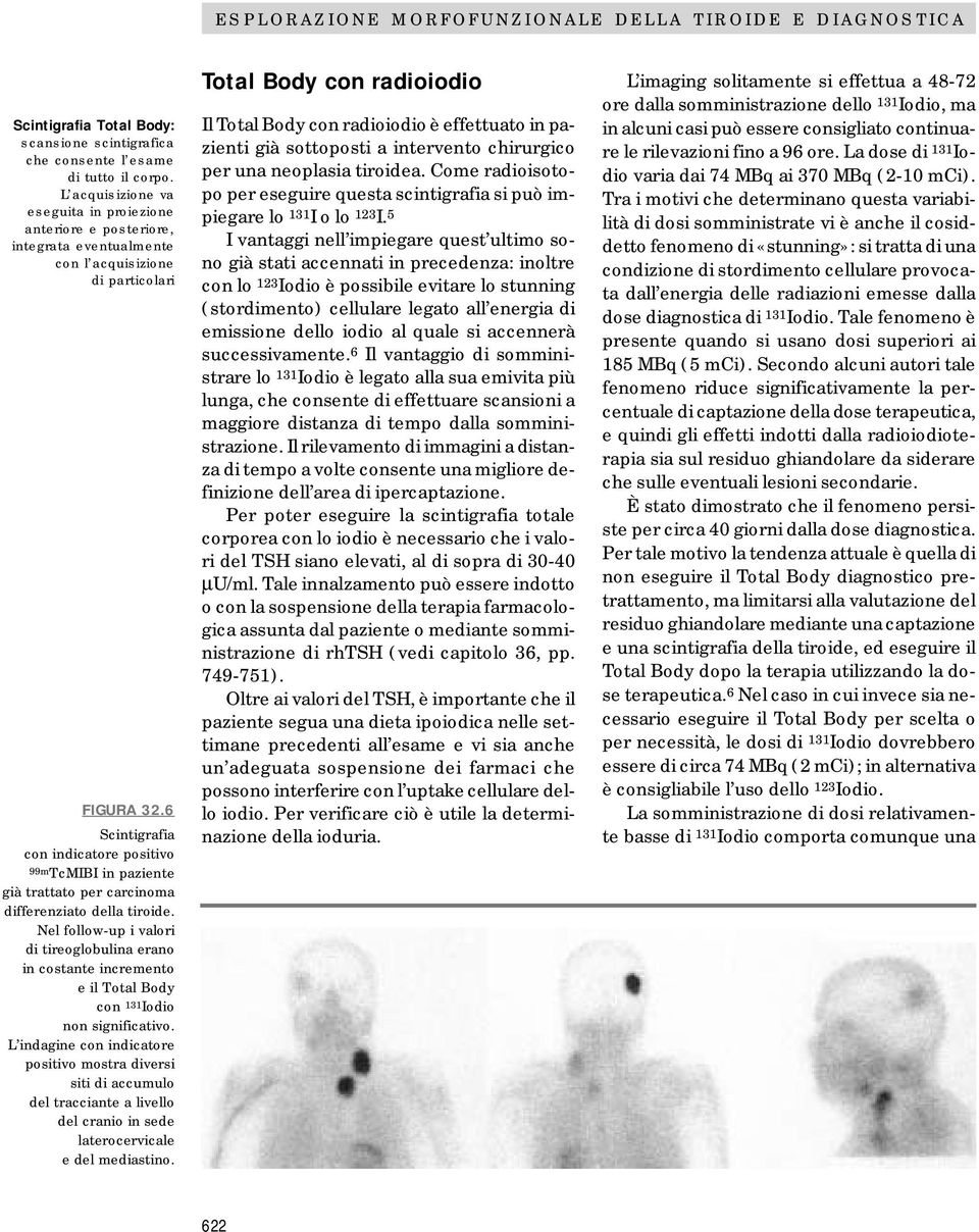 6 Scintigrafia con indicatore positivo 99mTcMII in paziente già trattato per carcinoma differenziato della tiroide.