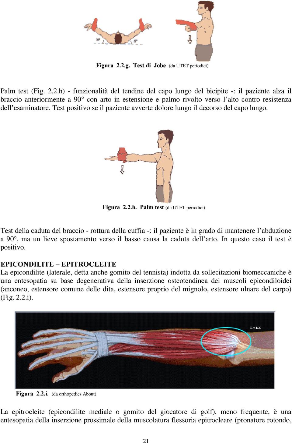 Test positivo se il paziente avverte dolore lungo il decorso del capo lungo.